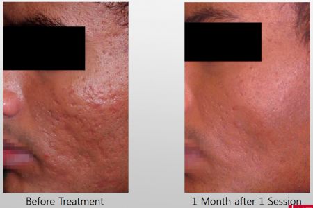 Infini-Before-After-41.jpg