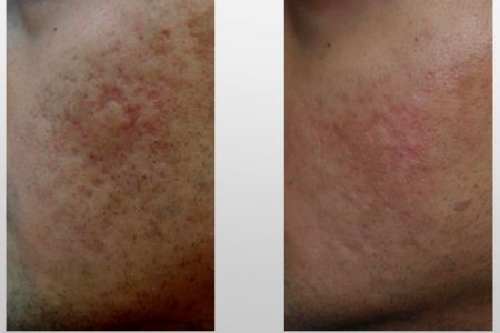 Infini-Before-After-39.jpg