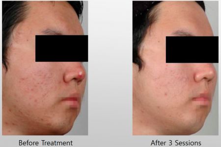 Infini-Before-After-45.jpg