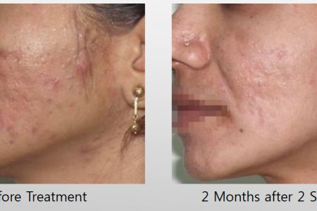 Infini-Before-After-36.jpg