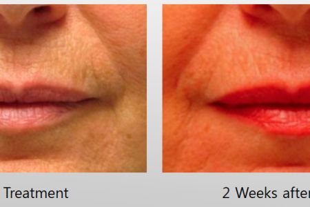 Infini-Before-After-4.jpg