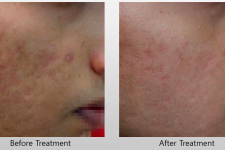 Infini-Before-After-37.jpg