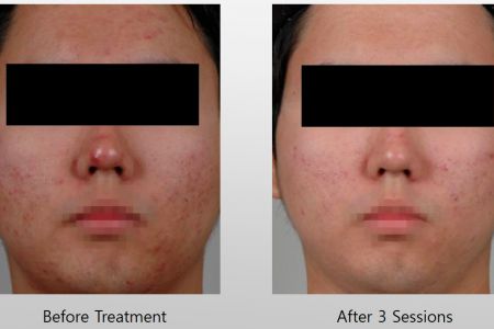 Infini-Before-After-44.jpg