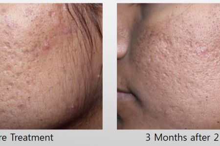 Infini-Before-After-33.jpg