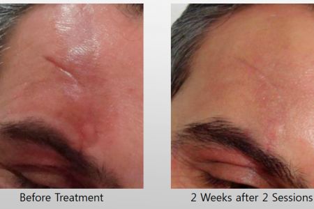 Infini-Before-After-25.jpg