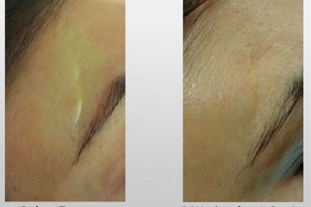 Infini-Before-After-24.jpg
