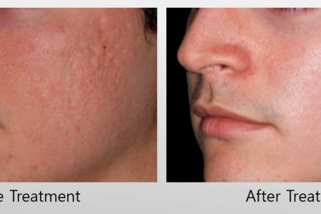 Infini-Before-After-23.jpg