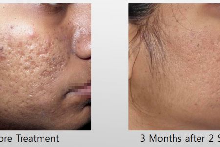 Infini-Before-After-34.jpg