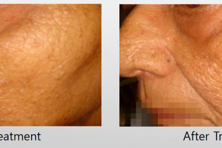 Infini-Before-After-15.jpg