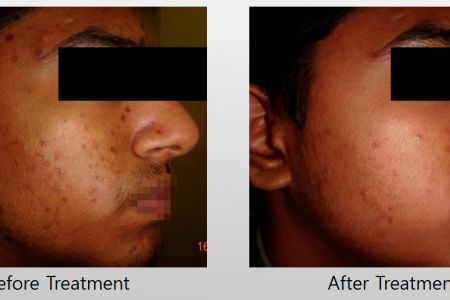Infini-Before-After-30.jpg