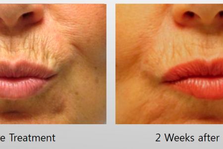 Infini-Before-After-5.jpg